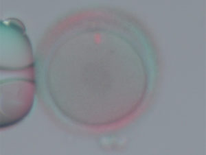 特殊なフィルターを用いて卵子内の紡錘体(12 時方向)を観察した卵子