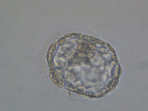 AH後の胚盤胞